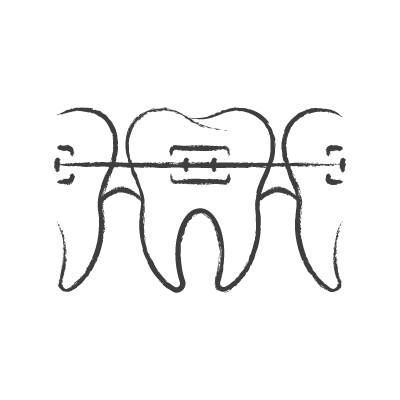 Monochromatyczny obraz zęba na ciemnym tle.